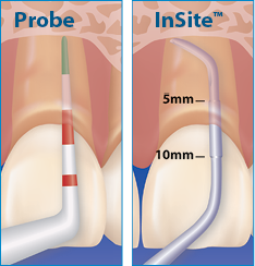 InSite-Illo