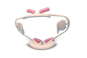 Lip and Cheek Retractor