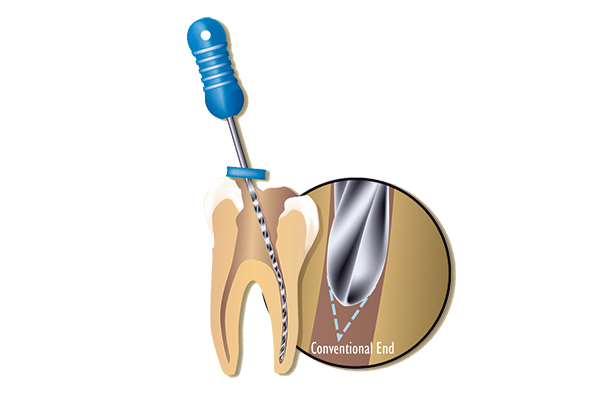 Premier Hedstrom File for Endodontics and root canals