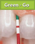 perioWise_Go PerioWise - Green Go