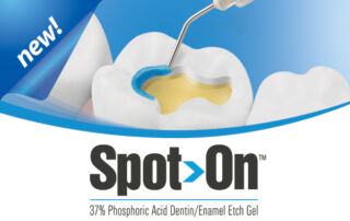 Premier Spot-On Etch Gel