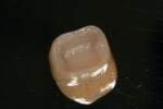 ZR-Cem - Zirconia Cementation Solution