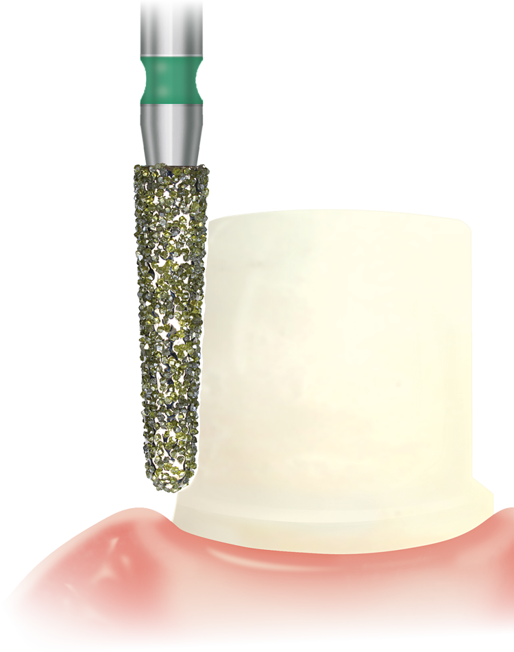 0426021_Priva-close-up-smartedge