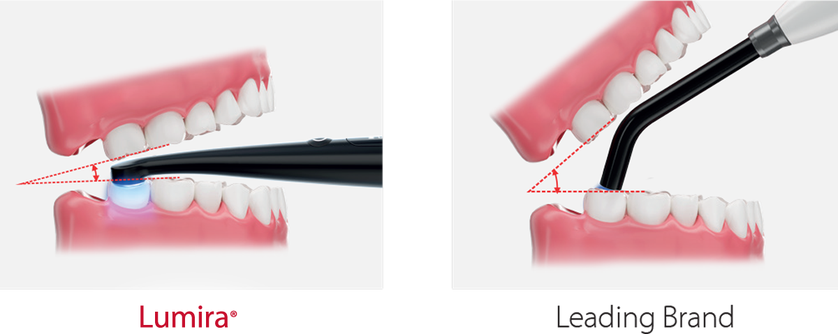 Lumira Low Profile Comparison