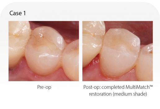 MultiMatch - Case 1
