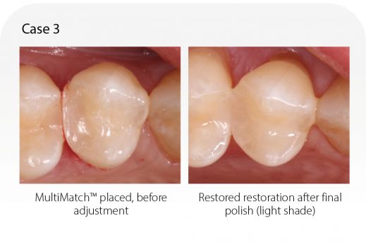 MultiMatch - Case 3